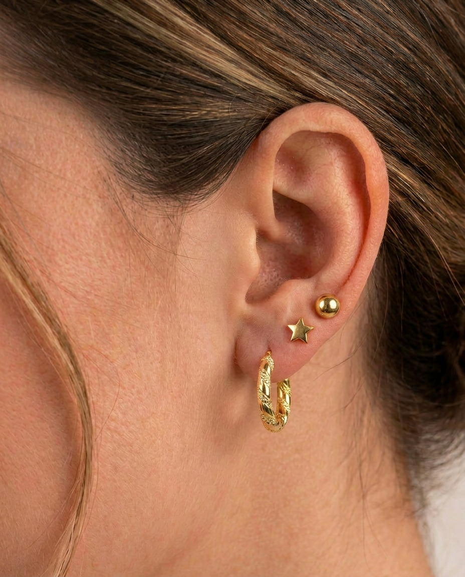 Aretes